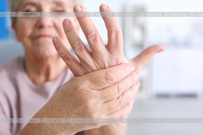 Bệnh viêm khớp nếu không điều trị kịp thời sẽ để lại nhiều biến chứng nguy hiểm