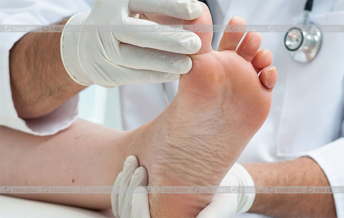 Bác sĩ khám lâm sàng, xét nghiệm nồng độ axit uric để kiểm tra bệnh