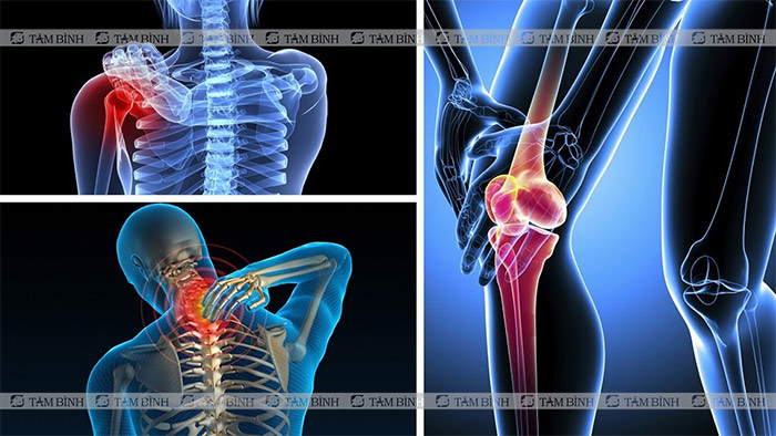 Bệnh xương khớp ngày càng có dấu hiệu trẻ hoá