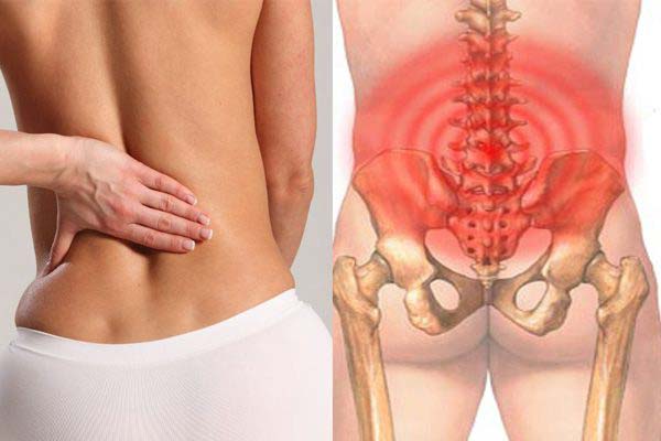Đau lưng dưới gây ra cảm giác khó chịu cho người bệnh