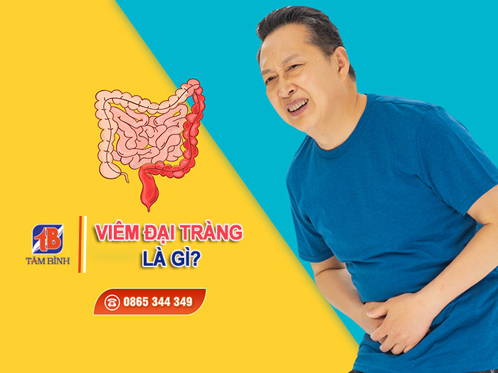 Viêm đại tràng: Nguyên nhân, triệu chứng, cách điều trị hiệu quả