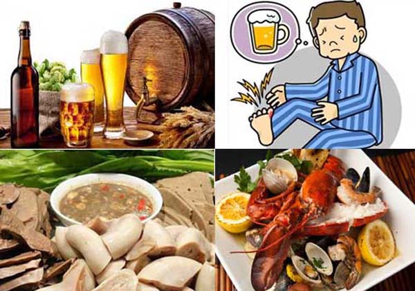 Có nhiều nguyên nhân dẫn đến bệnh gút