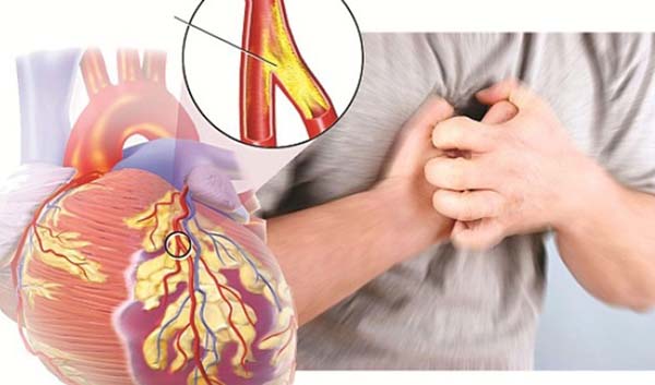 Béo phì dẫn đến bệnh lý nguy hiểm.