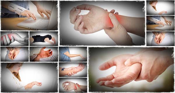 Chèn ép dây thần kinh cổ tay do hội chứng ống cổ tay