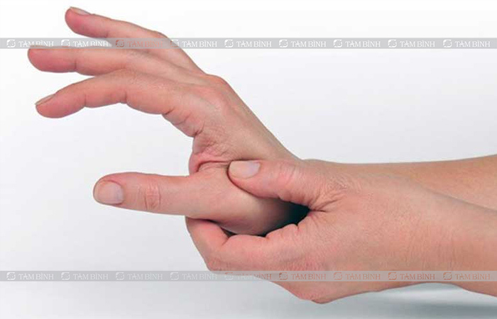 Bấm huyệt là một trong những cách điều trị hội chứng ống cổ tay bằng Đông y