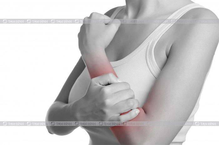 Viêm dây thần kinh cánh tay phải có thể gây ra những biến chứng nào?
