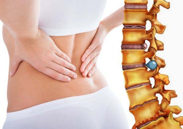 Thoái hóa cột sống có thể dẫn đến chèn ép và đau dây thần kinh liên sườn