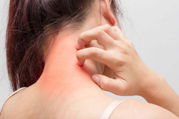 Dị ứng thức ăn có dấu hiệu như ngứa sưng lưỡi, nôn mửa, tiêu chảy, nổi mề đay, khó thở hoặc huyết áp thấp