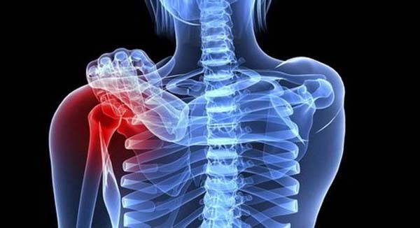 Ung thư xương là bệnh lý nguy hiểm, ảnh hưởng lớn tới sức khỏe và tính mạng
