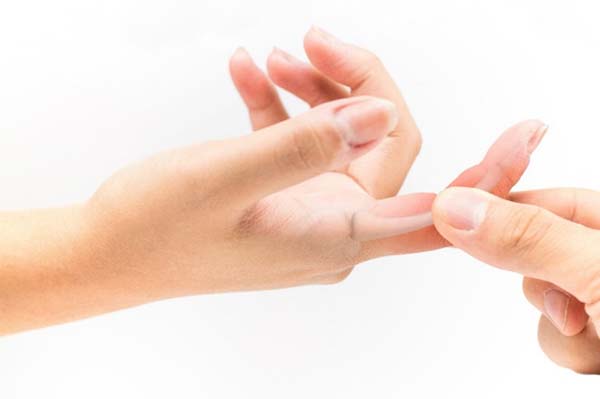Viêm khớp ngón tay là một dạng bệnh lý thuộc chứng viêm khớp