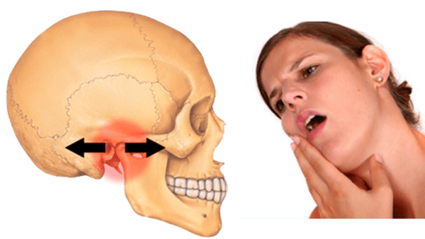 Bệnh có biểu hiện khó khai hoặc khó chịu trong khi nhai