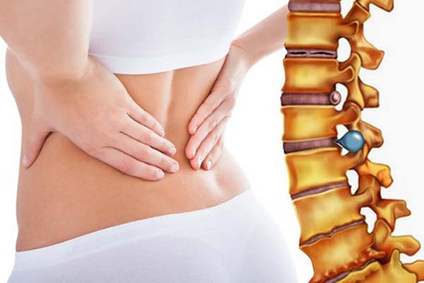 Đau cột sống thắt lưng - bệnh khó tránh ở phụ nữ.