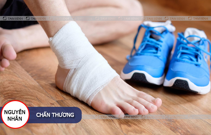chấn thương là một trong những nguyên nhân gây viêm khớp cổ chân