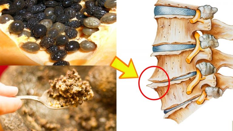 Cách chữa gai cột sống bằng hạt đu đủ