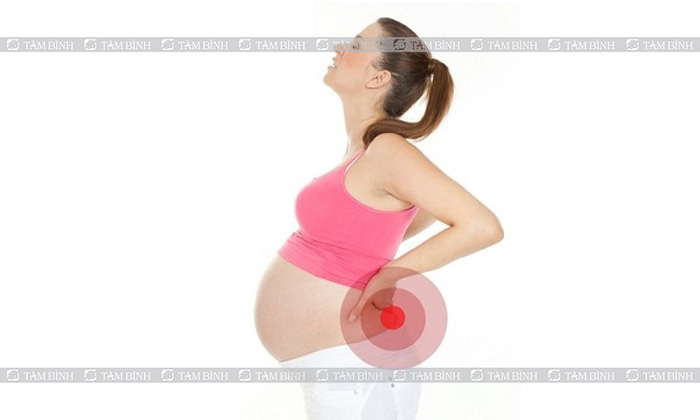 Đau lưng ở nữ giới khi mang thai