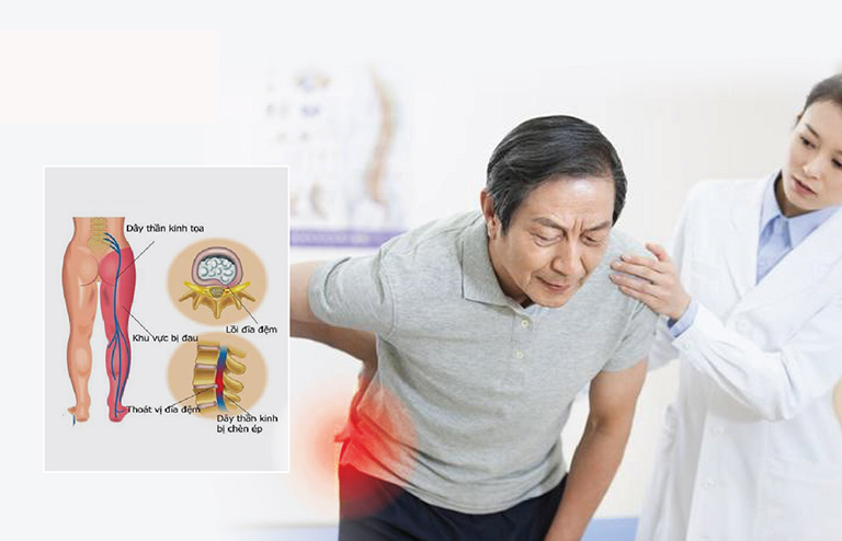 đau thần kinh tọa nên kiêng ăn gì 1