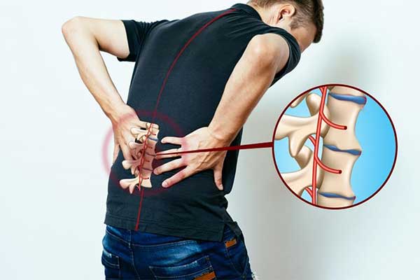 Đối tượng mắc viêm cột sống dính khớp
