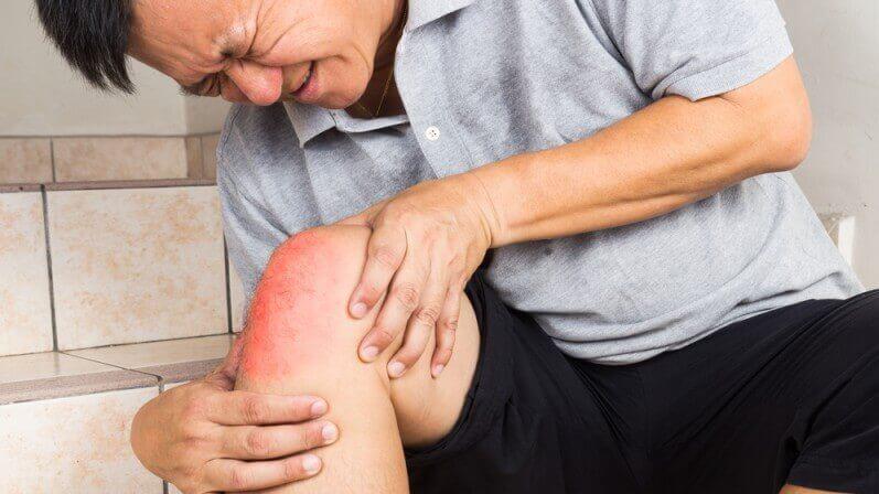 Sưng nóng đỏ là triệu chứng đau khớp gối