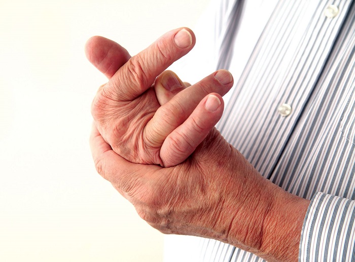 Bệnh Gout (gút) là gì? Nguyên nhân, triệu chứng và điều trị hiệu quả