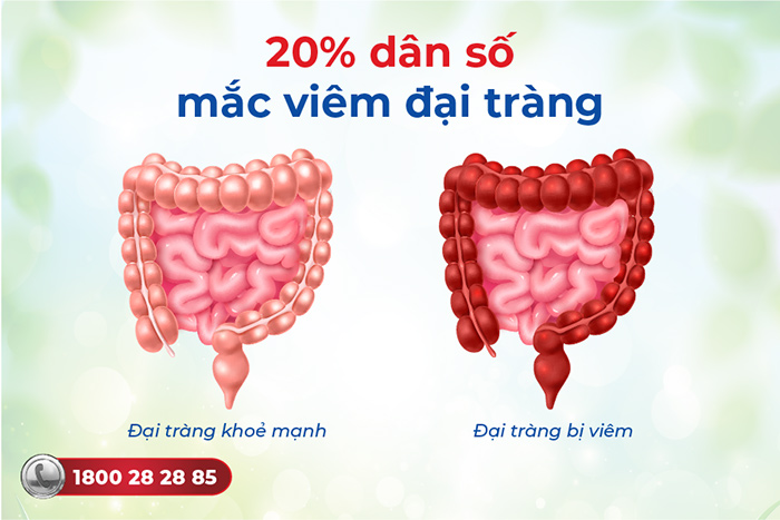 thực trạng viêm đại tràng 