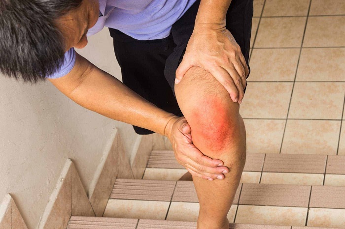 Bệnh viêm khớp gối 4