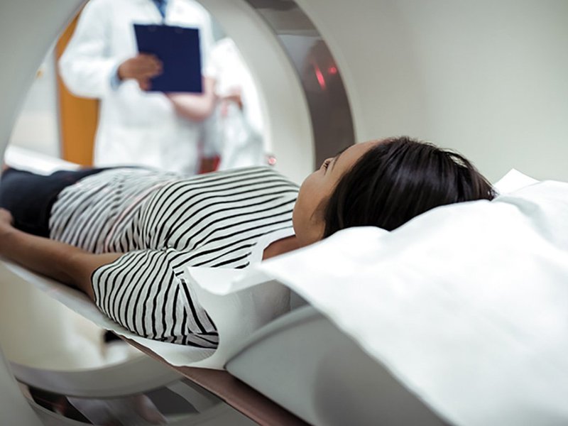 Chụp cộng hưởng MRI phát hiện lồi đĩa đệm