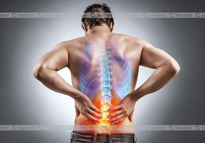 Mức độ nguy hiểm của gai cột sống