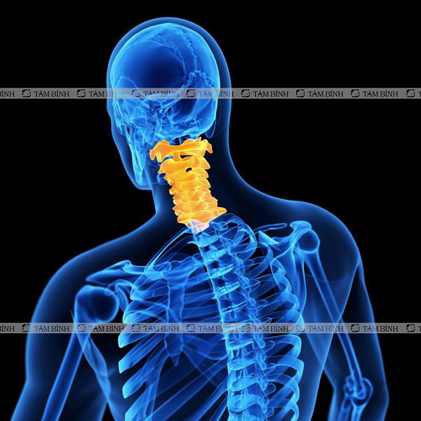 thoái hóa đốt sống cổ gây gên gai đốt sống cổ