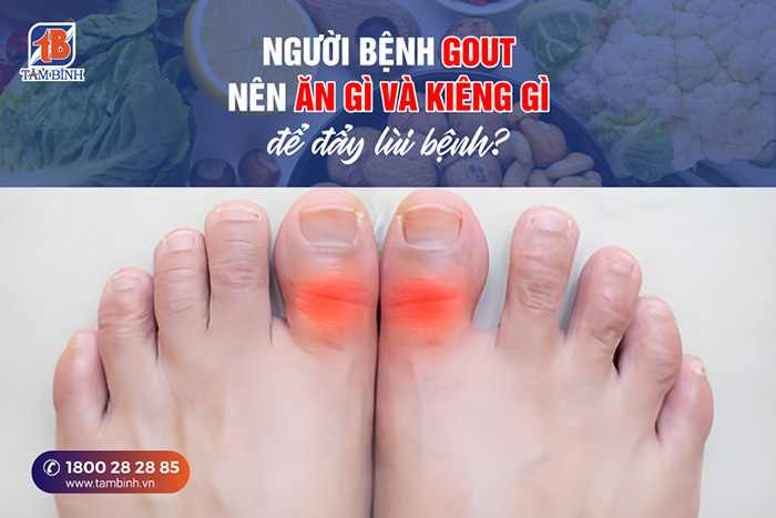 Người bệnh gout nên ăn gì và kiêng gì 