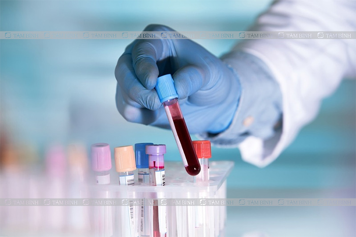 Bác sĩ tiến hành xét nghiệm máu để biết bạn có nhiễm khuẩn kiết lỵ hay không?