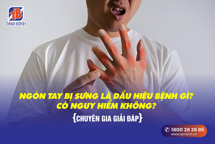 ngón tay bị sưng là bệnh gì