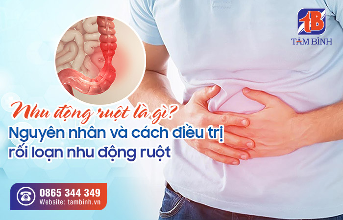 Cách điều trị và quản lý quai ruột hiệu quả như thế nào?
