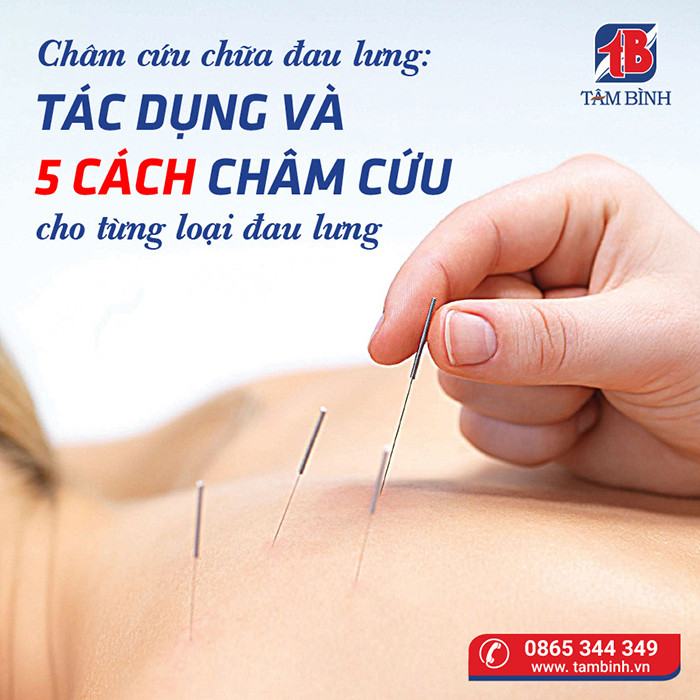 Châm cứu vùng lưng có thể giúp giảm đau và sưng trong bao lâu?