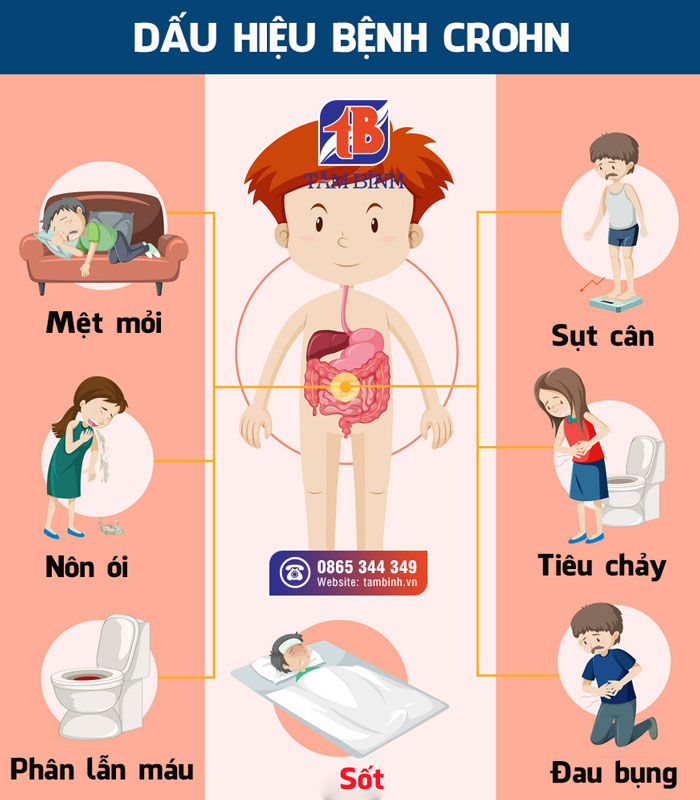 Một số triệu chứng của IBD