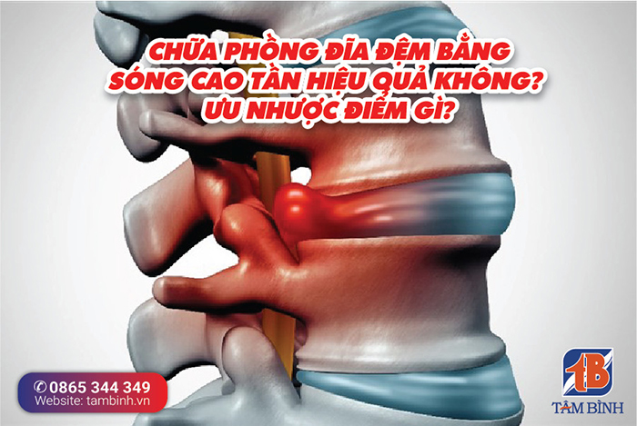 Tần số của sóng cao tần được sử dụng trong điều trị thoát vị đĩa đệm là bao nhiêu?
