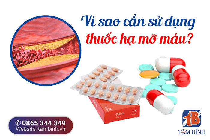 Thuốc Tây Điều Trị Mỡ Máu Cao: Giải Pháp Hiệu Quả Cho Sức Khỏe