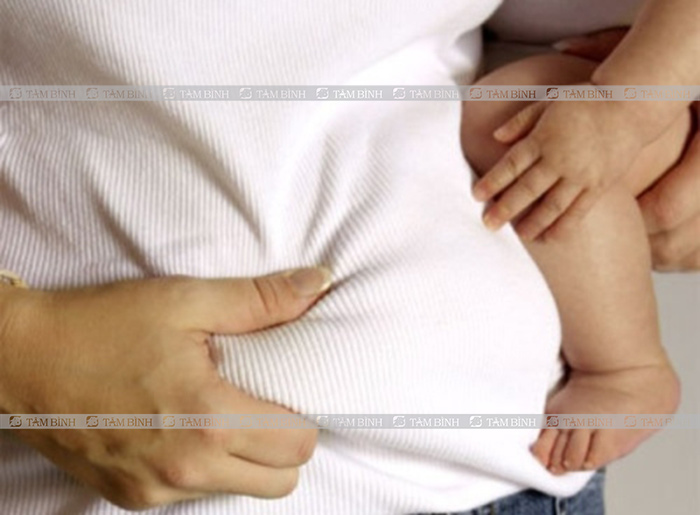 Thừa cân gây đau vùng xương cụt sau khi sinh