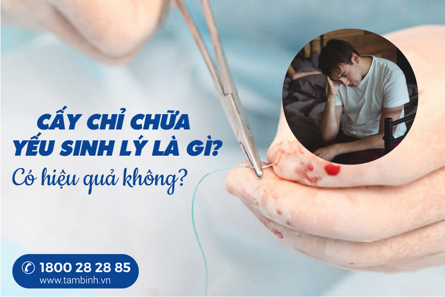 cấy chỉ chữa yếu sinh lý