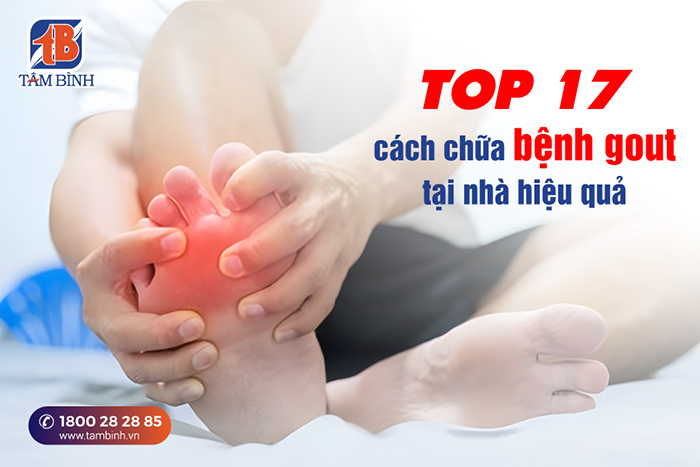 Điều trị bệnh gout tại nhà: Phương pháp hiệu quả giúp giảm đau và cải thiện sức khỏe