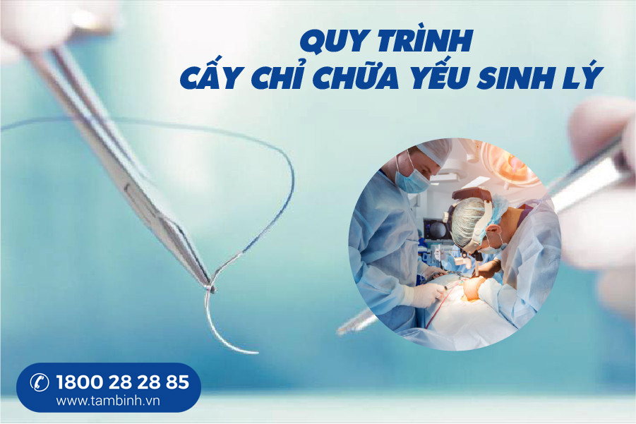 quy trình cấy chỉ chữa yếu sinh lý