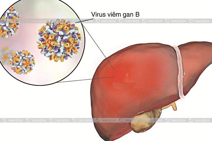Virus viêm gan B