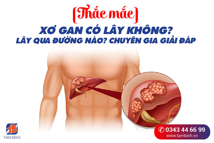 Bệnh Viêm Gan Có Lây Không?