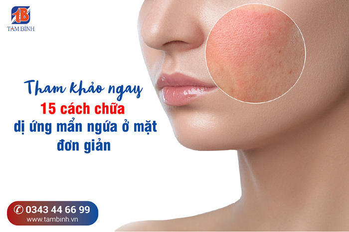 Những cách giúp  giảm ngứa da mặt  hiệu quả