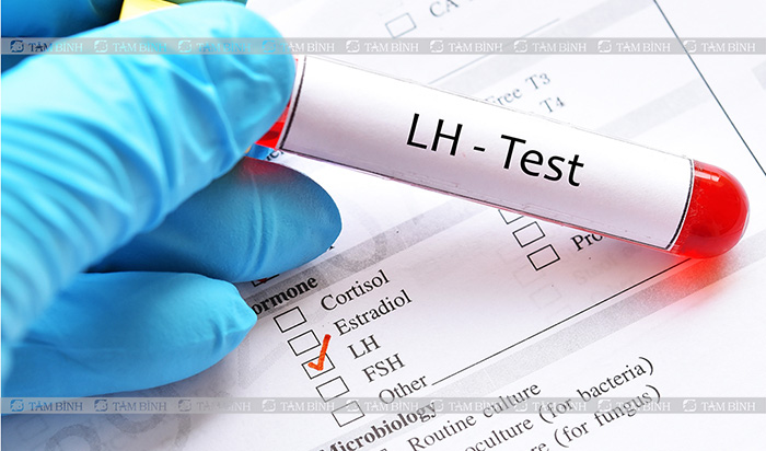 xét nghiệm nội tiết tố LH
