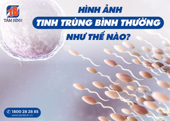 hình ảnh tinh trùng bình thường