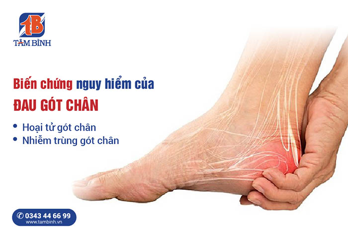Đau gót chân là triệu chứng của nhiều bệnh lý