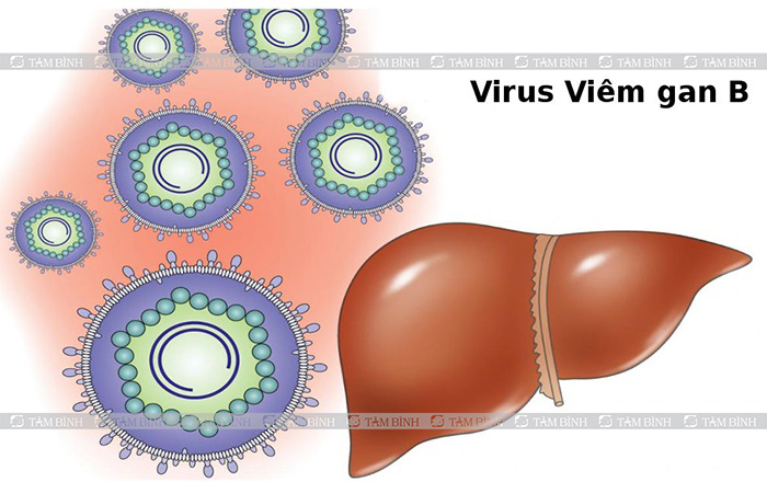 Viêm gan B do virus viêm gan B gây ra