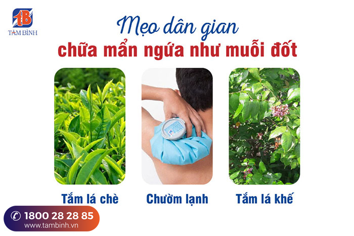 Chữa nổi mẩn ngứa tại nhà