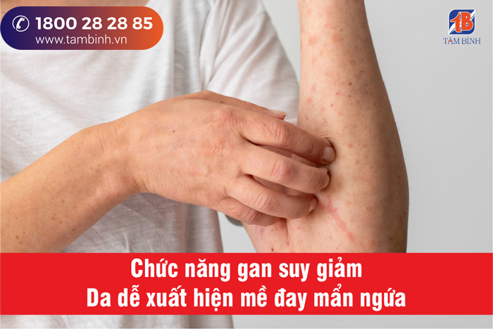 4. Biện pháp phòng ngừa và sinh hoạt hợp lý