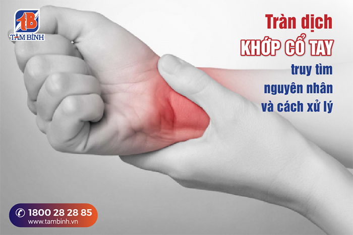 Tràn dịch khớp cổ tay là gì